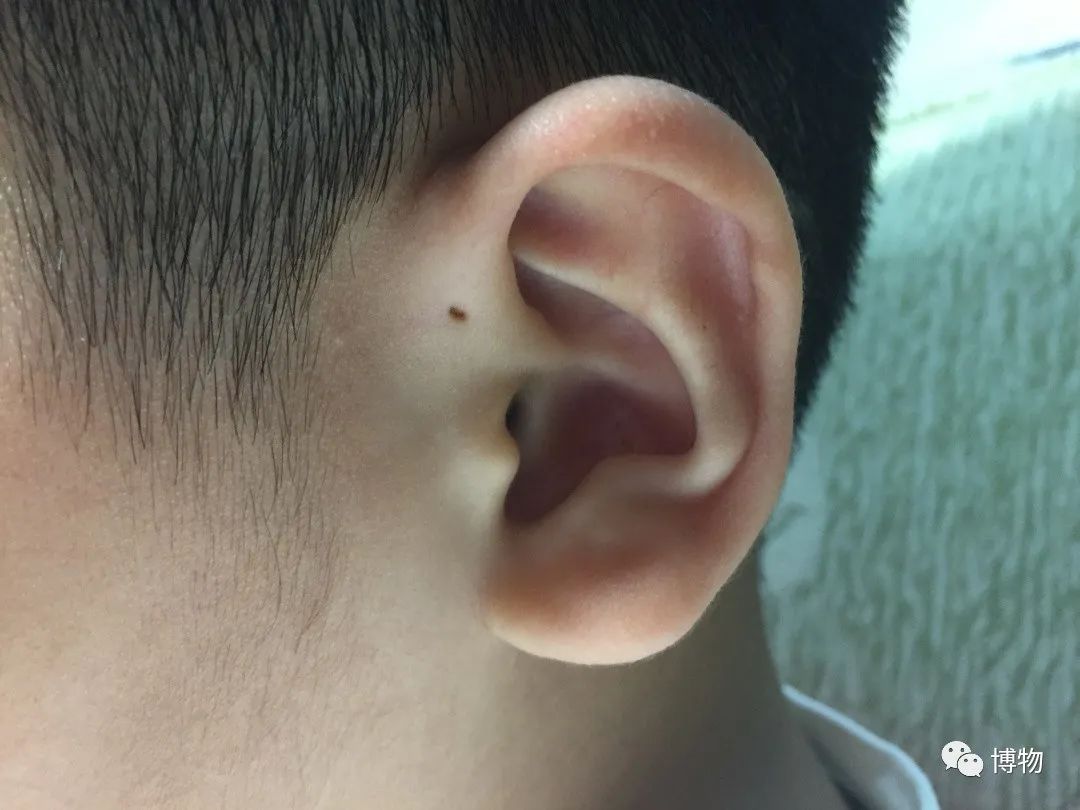 耳朵里面总是痒痒的，是什么情况？是不是耳朵里面出什么问题了？_耳道